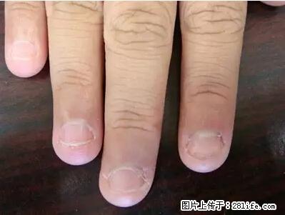 剪指甲、挖耳屎，这些日常小动作竟隐藏大危害！ - 聊城生活资讯 - 聊城28生活网 lc.28life.net
